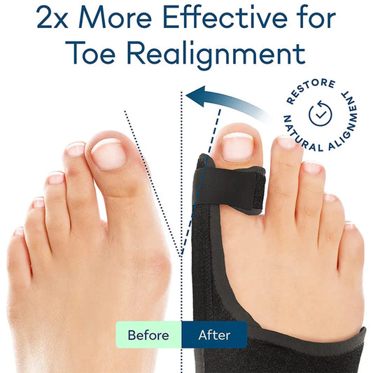 Toe Hallux Valgus Corrector