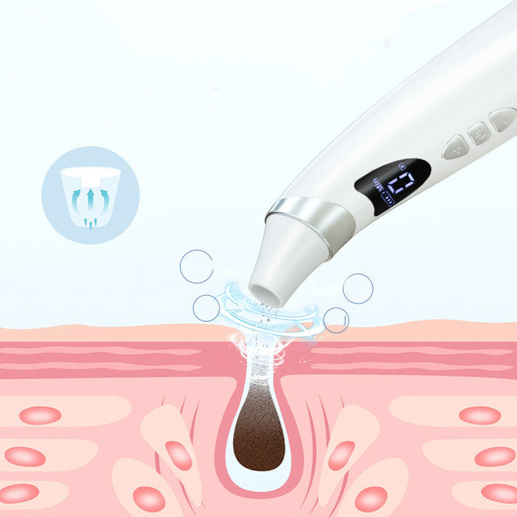 Electric Visual blackhead pore cleaner