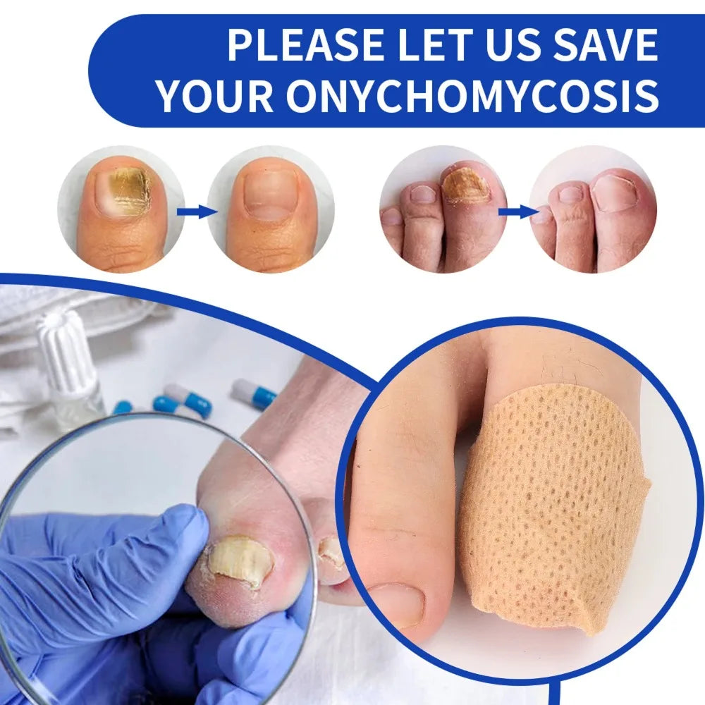 Nail Repair Patches