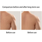Foaming Back Exfoliating Strong Scrub Towel