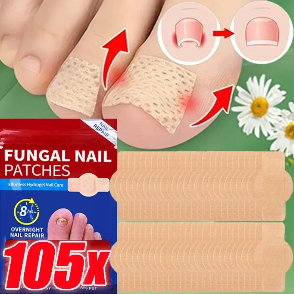 Nail Repair Patches